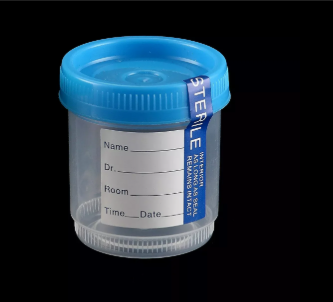 Urine Container - Non Sterile